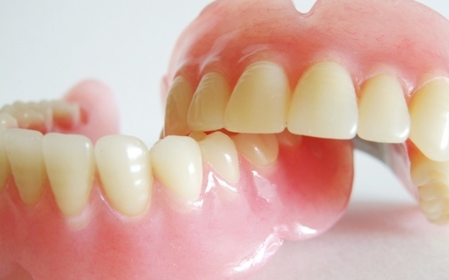 無くなった歯の治療